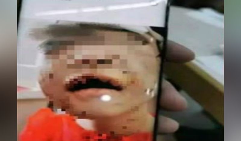 heartless stepmother abuses 4 year old daughter during lockdown cuts lips with scissors for calling her mummy kph