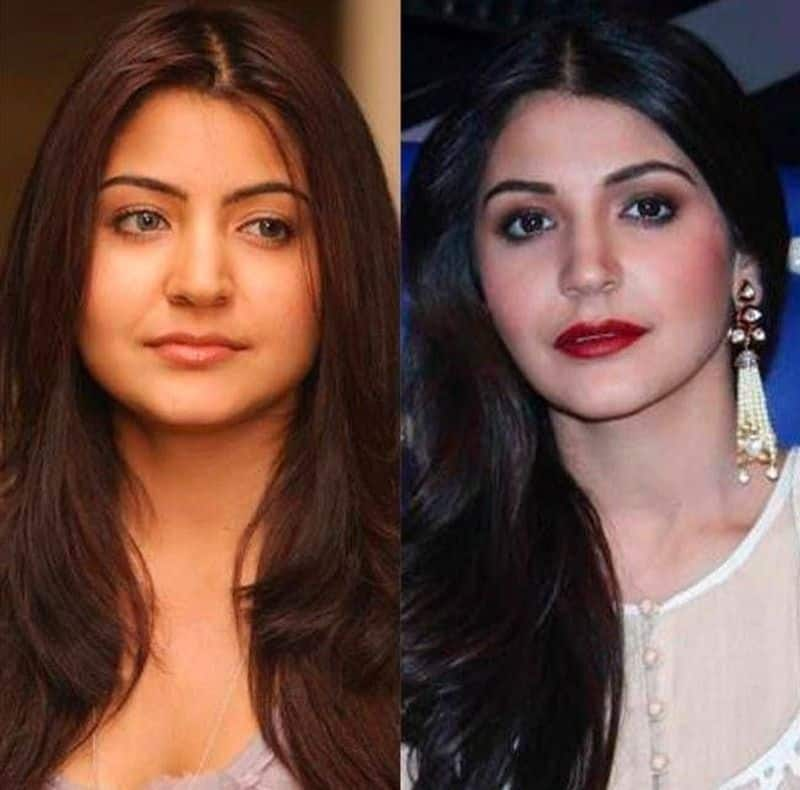 anushka sharma before after