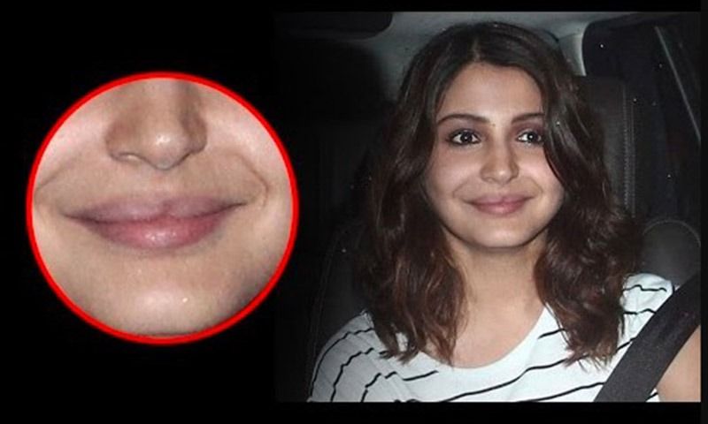 আদিত্য চোপড়ার কথাতে কি অনুষ্কা এতটাই আঘাত পেয়েছিলেন যে নিজের প্রতিভার উপর আর ভরসাই রাখতে পারলেন না।