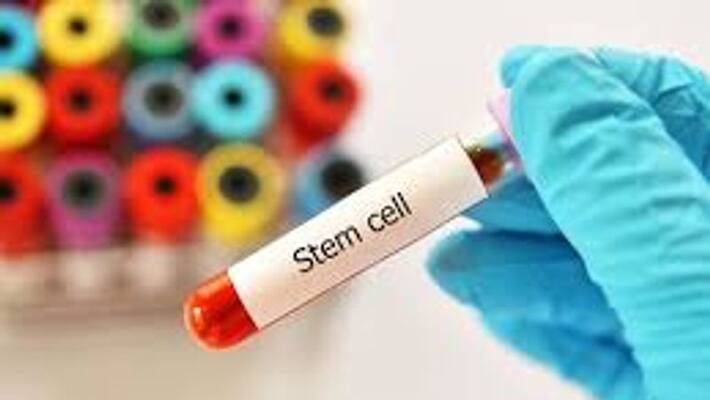 Stem Cell Therapy For COVID 19 in UAE Stem Cell Therapy For COVID 19 in UAE