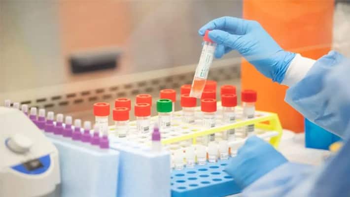 Corona testing lab mistake 3 found negative Corona testing lab mistake 3 found negative