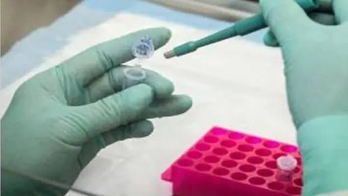 Covid19 lab to be start in kmc Covid19 lab to be start in kmc