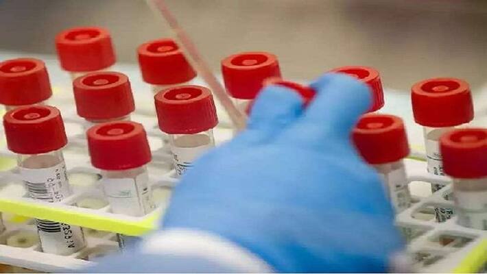the small changers in corona virus genetic - american scientist invention the small changers in corona virus genetic - american scientist invention