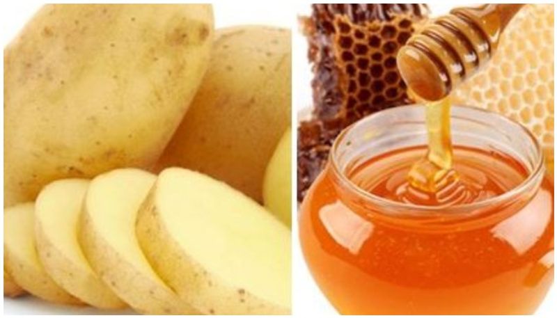 To get a healthy and soft skin Try this potato juice