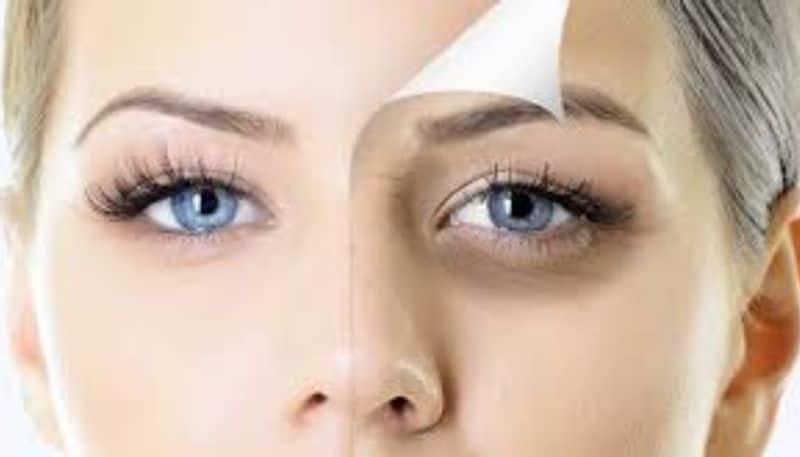 Get rid of the problem of dark circles easily at home before the New Year party BDD