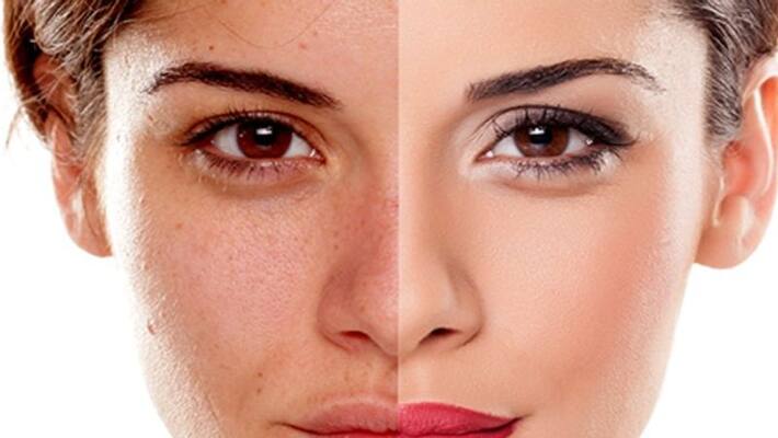skin ageing can resist through these tips skin ageing can resist through these tips