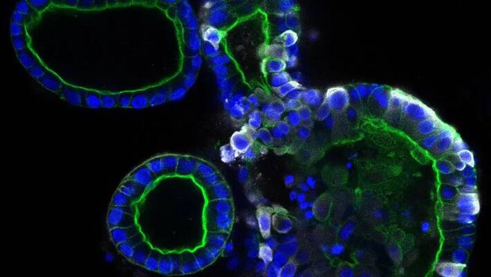 British and Netherlands scientist's capture corona image in stomach British and Netherlands scientist's capture corona image in stomach