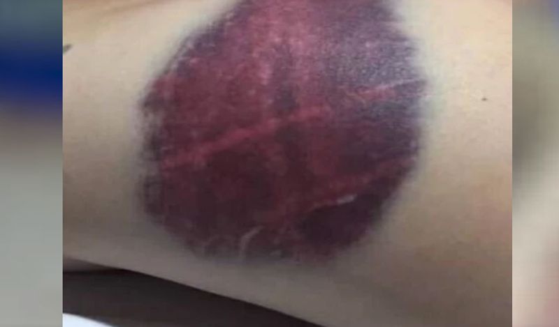 online boyfriend physically abused woman after she stuck with him in lockdown in another country kph