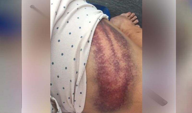 online boyfriend physically abused woman after she stuck with him in lockdown in another country kph