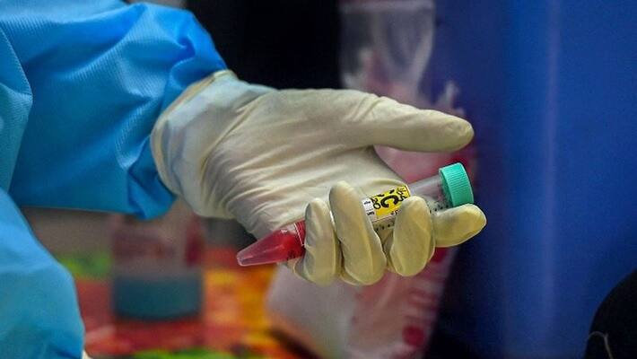 at least 10 years to find medicine for covid19 says scientist praveen rao nekkar at least 10 years to find medicine for covid19 says scientist praveen rao nekkar