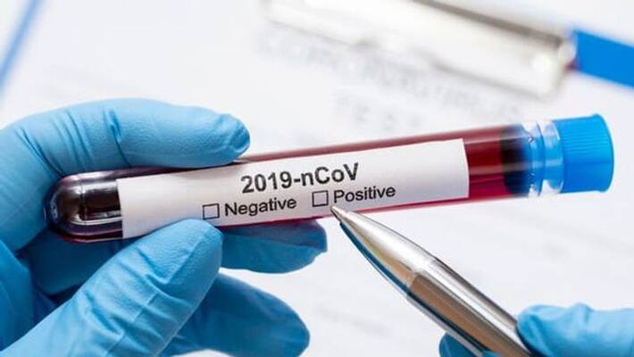 2709 New Coronavirus cases reported in India 93 death 2709 New Coronavirus cases reported in India 93 death