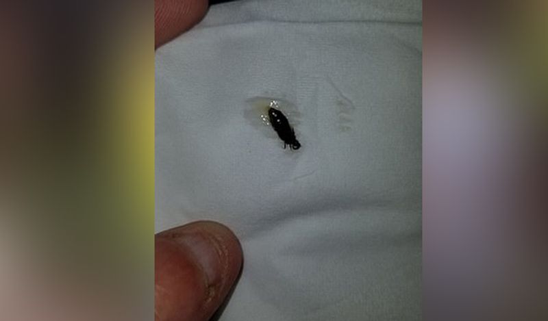 horrific photos of beetle coming out of 6 year old girl will churn your stomach kph