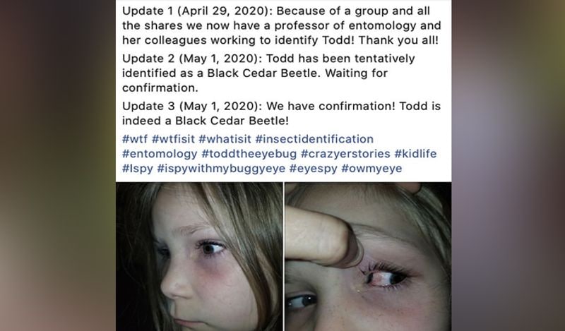 horrific photos of beetle coming out of 6 year old girl will churn your stomach kph