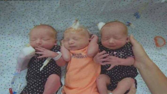 Corona virus infection in triplets born at the same time ... Doctors in shock Corona virus infection in triplets born at the same time ... Doctors in shock
