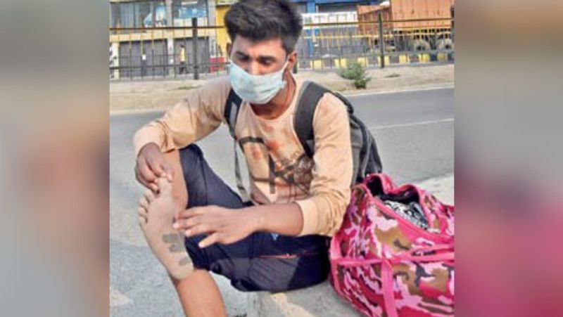 यह तस्वीर हरियाणा के गुड़गांव की है। जहां श्रवण नाम का युवक 1000 किमी दूर घर जाने के लिए पैदल ही निकल पड़ा। चलते-चलते उसके पैर में छाले पड़ गए।