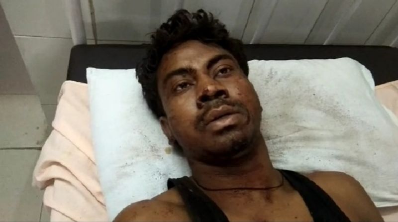हादसे में घायल कानपुर के अस्पताल में भर्ती मजदूर रामसजीवन ने बताया कि हादसा बेहद भयावह था। वह जग रहा था और चाय पी पर डीसीएम में आया ही था, उसी समय पीछे से एक गाड़ी की लाइट दिखाई पड़ी लेकिन हाईवे पर तमाम गाडियां चल रही थी। लेकिन कुछ समझ आता इसके पहले ही पीछे से ट्रक ने जोरदार टक्कर मारी। एक धमाका सा हुआ और गाड़ी पलट गई। उसी में मेरा सिर भी फट गया। लेकिन ईश्वर की कृपा है कि हम ज़िंदा हैं। अंधेरा होने की वजह से हमे मदद मिलने में कुछ देरी हुई अन्यथा कई लोग जिंदा बचाए जा सकते थे।
