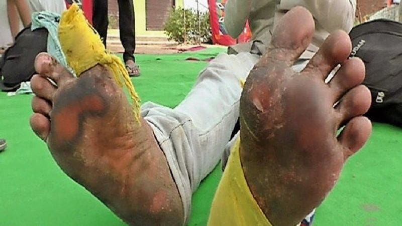 दिल दहला देने वाली यह तस्वीर माऊंट आबू से सामने आई है। जहां कुछ दिन पहले यूपी के बलरामपुर से माऊंट आबू घूमने आए बलरामसिंह यादव अपने दोस्तों के साथ आए थे, लेकिन लॉकडाउन में फंस गए।बलराम ने कभी नहीं सोचा था कि वह यादों में इस तरह का दर्द लेकर वापस जाएगा। उसके पैरे में छाले पड़ गए हैं। जब उसके पैरों से खून रिसने लगा तो उसने अपनी शर्ट को फाड़कर तलवे में पट्टी बांध ली।
