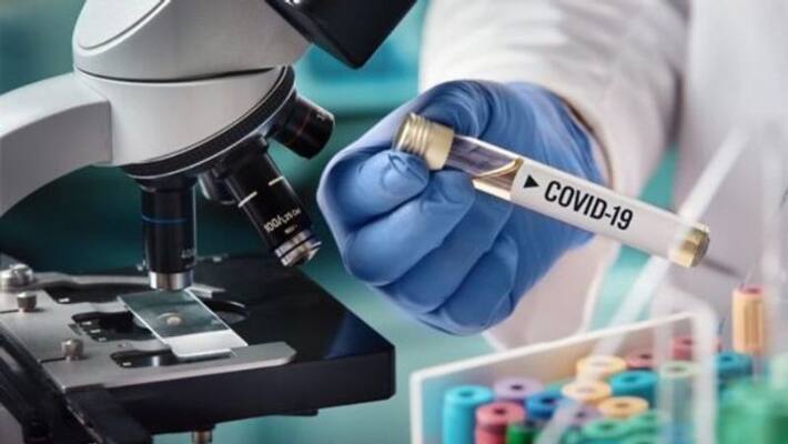 ten expatriates died in saudi due to covid 19 ten expatriates died in saudi due to covid 19