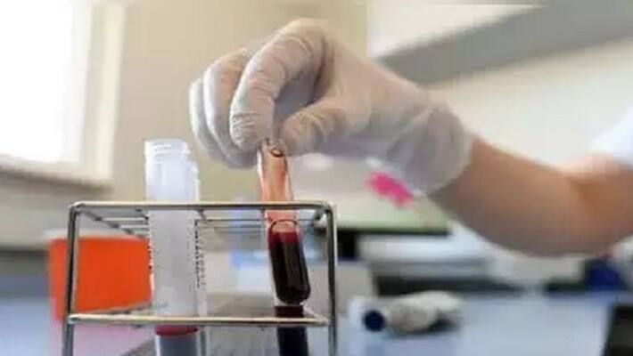 127 new corona cases reported in telangana 127 new corona cases reported in telangana