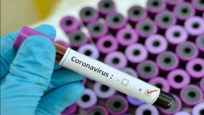 10 more new Corona Case Found in Shivamogga on Tuesday 10 more new Corona Case Found in Shivamogga on Tuesday