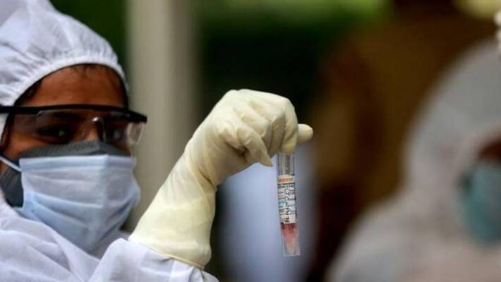 Coronavirus testing has increased 1000 times in 2 month kpn Coronavirus testing has increased 1000 times in 2 month kpn