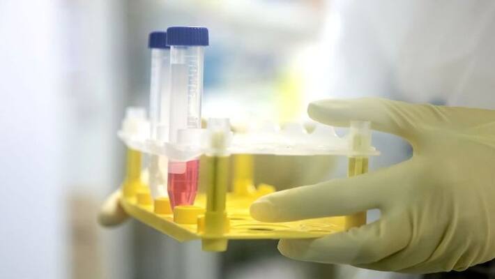india is in early stage for developing vaccine against covid 19 india is in early stage for developing vaccine against covid 19
