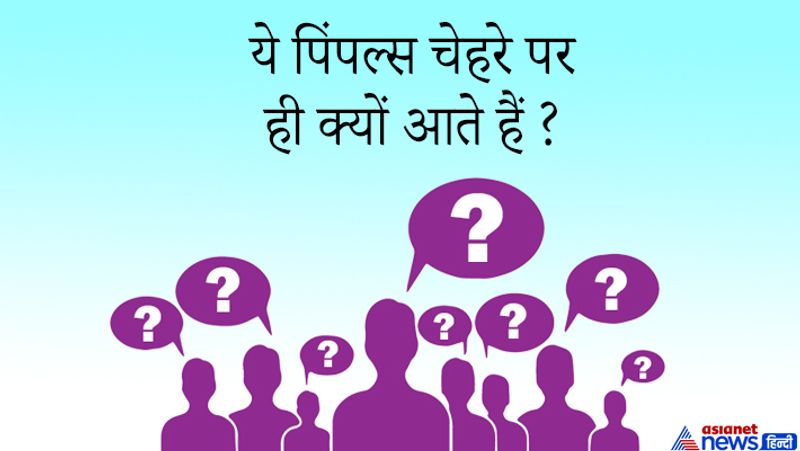 जवाब: यूपीएससी वाले कैंडिडेट को हर विषय की जानकारी होनी चाहिए इसलिए आम जिंदगी वाले सवाल पूछ लिए जाते हैं जिनका सीधा मतलब विज्ञान से होता है। इस सवाल का जवाब कैंडिडेट ने ऐसे दिया- आमतौर पर एंड्रोजन हार्मोन द्वारा पिंपल को ट्रिगर किया जाता है, इसके अलावा स्किन ओयली होने की वजह भी पिंपल होते हैं दूसरा ये समस्या जेनेटिक भी हो सकती है। 