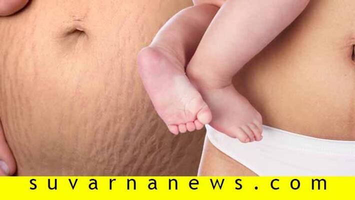 Here are postpregnancy skincare tips Here are postpregnancy skincare tips