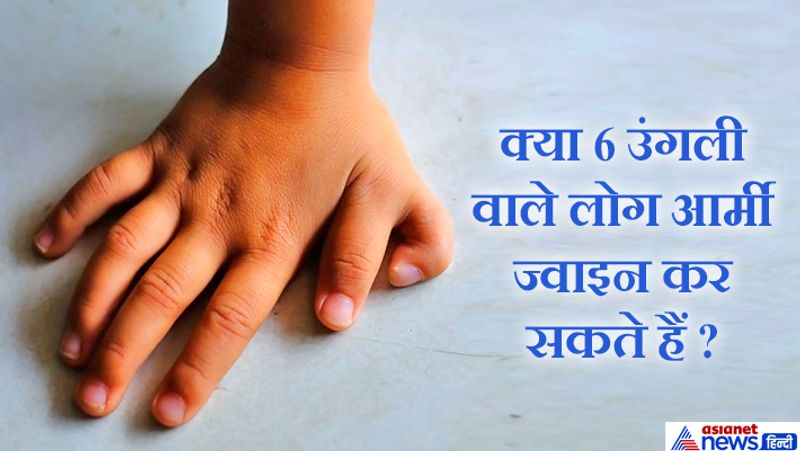 जवाब: जी नहीं, आर्मी नियम के अनुसार 6 उंगली वाले फौज में नहीं जा सकते, उन्हें सर्जिकल ओपरेशन से ये एक्स्ट्रा फिंगर हटानी पड़ेगी।