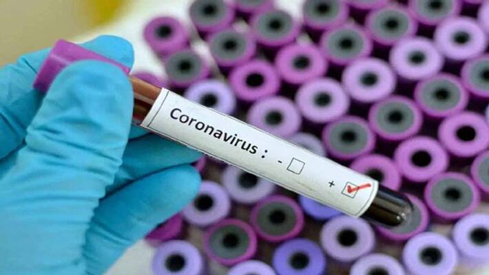 94 New corona cases reported in telangana 94 New corona cases reported in telangana