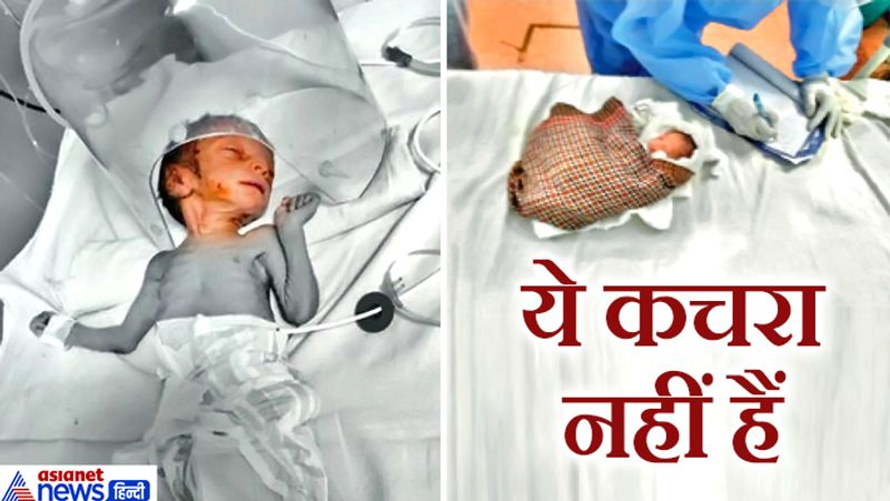 पहले जानते हैं दूसरी तस्वीर में दिखाई दे रही बच्ची के बारे में। भोपाल की एनआरआई कालोनी में रहने वाले कमल पंजवानी ने सबसे पहले बच्ची के रोने की आवाज सुनी थी। उन्होंने पुलिस को सूचित किया और फिर बच्ची को उठाकर अस्पताल में भर्ती कराया गया। बच्ची को जन्म के 4-5 घंटे बाद ही फेंक दिया गया था। आगे पढ़ें पहली तस्वीर में दिख रहे कुपोषित बच्चे की कहानी...