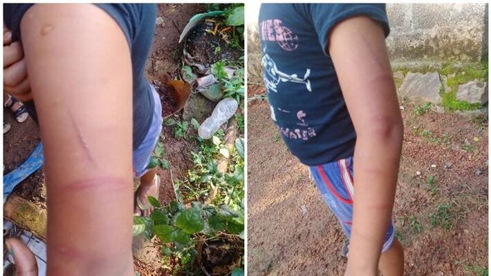 police booked case against tuition teacher for bear third standard student police booked case against tuition teacher for bear third standard student