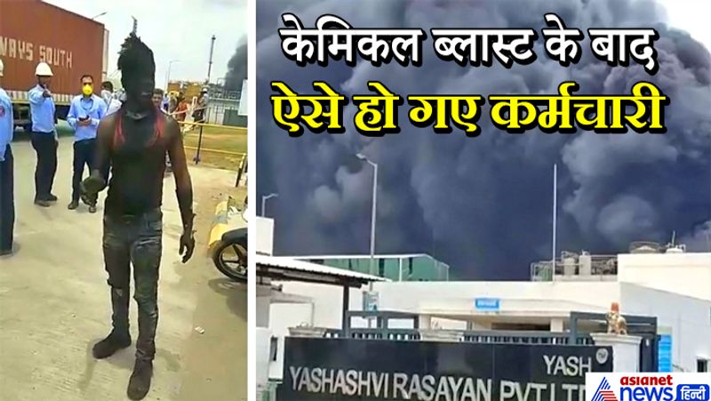 घटना की वजह अभी सामने नहीं आई है। फायर बिग्रेड ने समय पर पहुंचकर करीब 4 घंटे की मशक्कत के बाद आग पर काबू पाया। ब्लास्ट में घायल एक कर्मचारी।