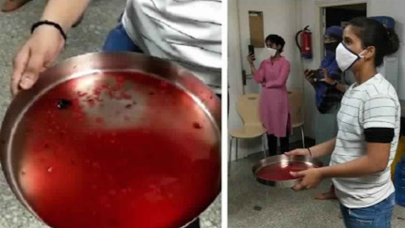 वहीं एबीवीपी कार्यकर्ताओं का कहना था कि जब खून ही चूसना है तो फिर अप्रत्यक्ष क्यों? हम प्रत्यक्ष में खुन लेकर आपके लिए आए हैं। हालांकि घटना की जानकारी लगते ही प्रतापनगर थाना पुलिस ने मौके पर पहुंचकर मामले को शांत कराया।
