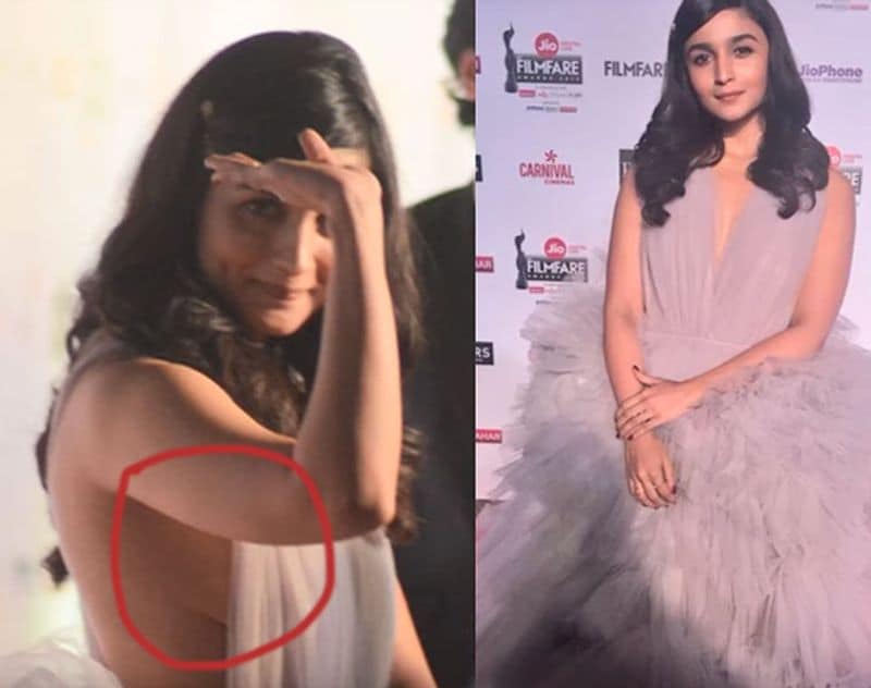 Bollywood actress Alia Bhatt, one of the talented actresses in the film industry encountered a major oops moment at the 63rd Filmfare Awards 2018, held in Mumbai.

