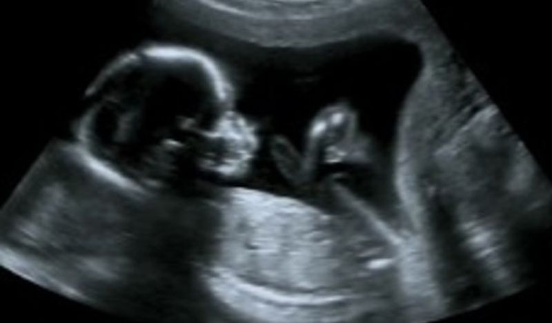मारी गई युवती 7 महीने की प्रेग्नेंट थी। महिला ने उसका पेट फाड़ बच्चे को बाहर निकाल लिया और उसे अपने साथ ले भागी। 
