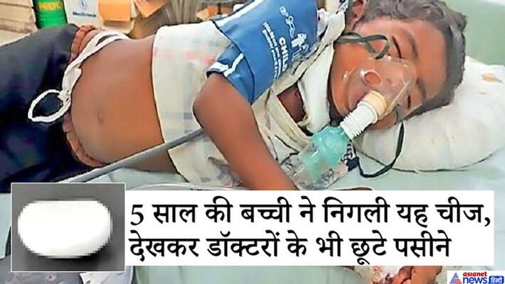 Shocking disease, 5-year-old girl eat stones, know about a complicated operation kpa Shocking disease, 5-year-old girl eat stones, know about a complicated operation kpa