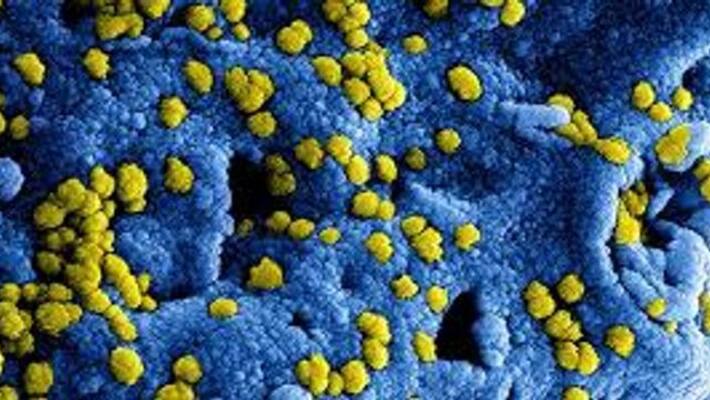coronavirus cases, new infections 10956, deaths 396 coronavirus cases, new infections 10956, deaths 396