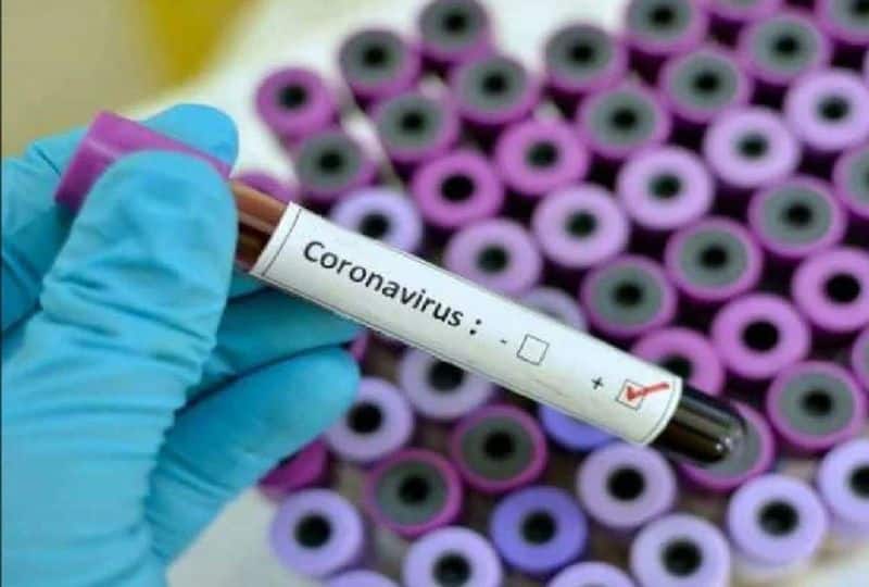 Osmania medical college data operator tests corona virus