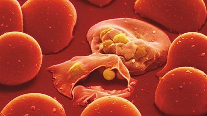 Malaria Symptoms Prevention and Home Remedies disease and conditions kpv Malaria Symptoms Prevention and Home Remedies disease and conditions kpv
