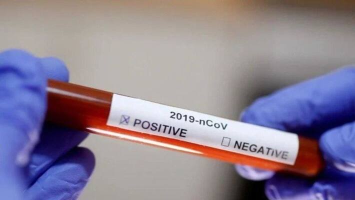 213 new corona cases reported in telangana 213 new corona cases reported in telangana