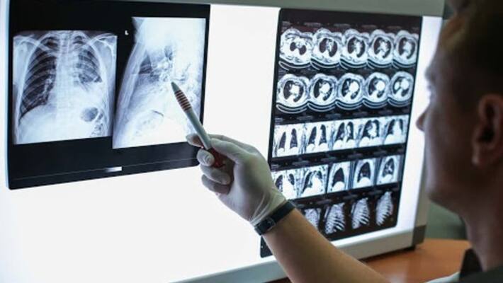 study says that one in five people at risk of severe covid 19 study says that one in five people at risk of severe covid 19