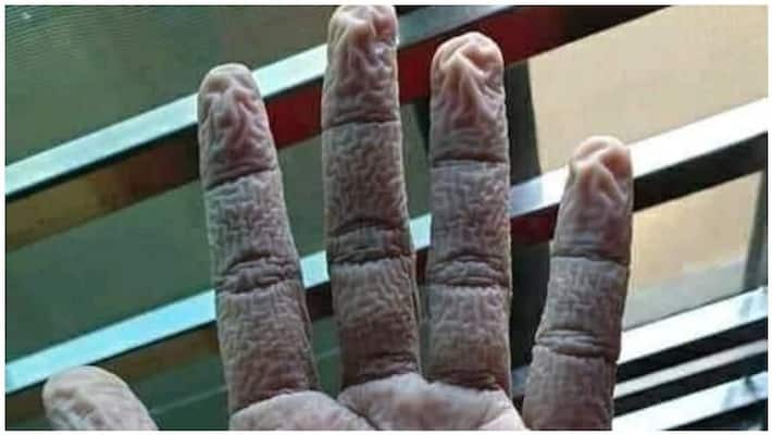 After these hands vowed to restore life until dawn ... 14 days of the doctors are gone After these hands vowed to restore life until dawn ... 14 days of the doctors are gone
