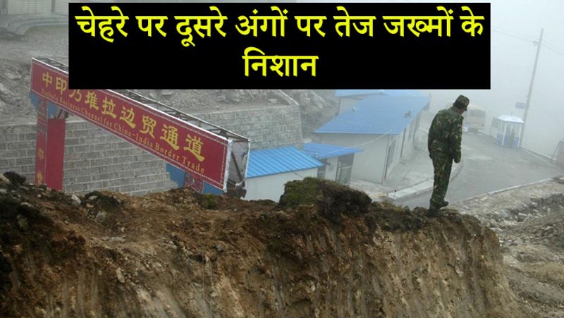 पोस्टमार्टम रिपोर्ट में खुलासा हुआ कि शहीदों के चेहरे और दूसरे अंगों पर तेज जख्मों के निशान मिले हैं।
