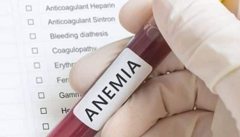 main symptoms of sickle cell anemia