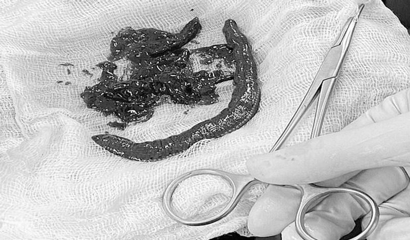 Leech enters pensioner's penis while he was swimming in a pond