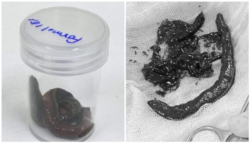 Leech enters pensioner's penis while he was swimming in a pond