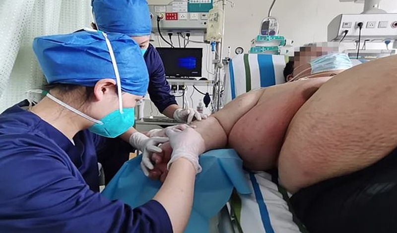 chinese man gained 101 kg weight in just 5 months staying home during lockdown kph