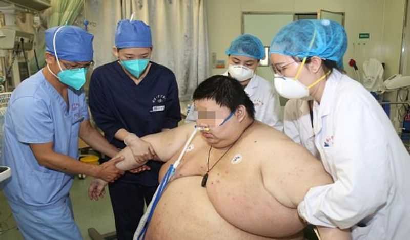 chinese man gained 101 kg weight in just 5 months staying home during lockdown kph