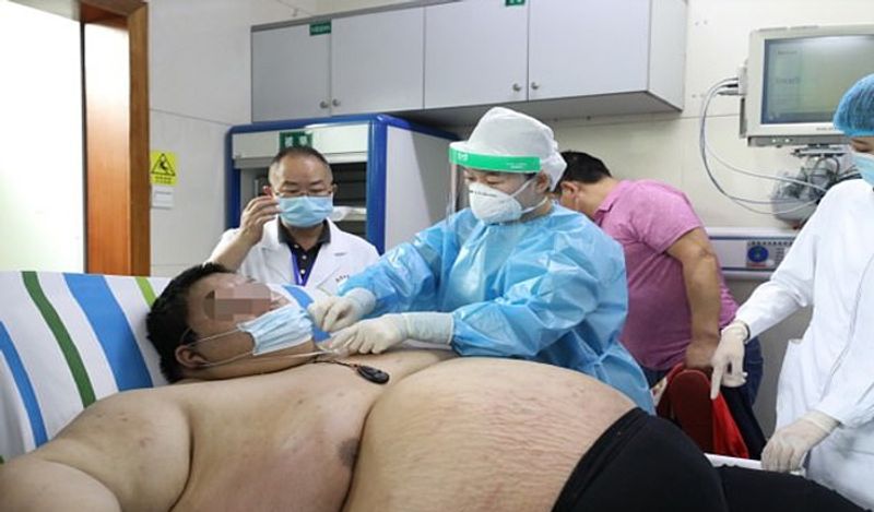 chinese man gained 101 kg weight in just 5 months staying home during lockdown kph